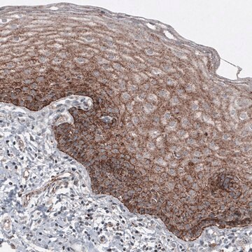 Monoklonalny anty-LAMP1 Prestige Antibodies&#174; Powered by Atlas Antibodies, clone CL4489, purified immunoglobulin