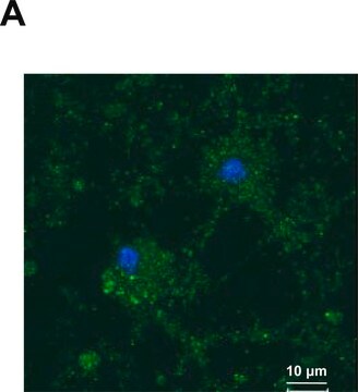 抗-YB-1（C-端） 兔抗 ~1.0&#160;mg/mL, affinity isolated antibody, buffered aqueous solution