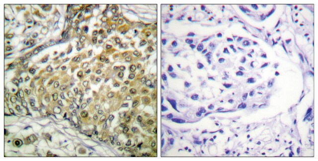 Anti-p53 (Acetyl-Lys379), C-Terminal antibody produced in rabbit affinity isolated antibody