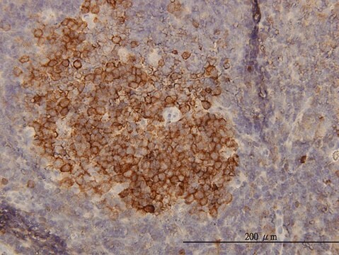 Monoclonal Anti-PHGDH antibody produced in mouse clone 4A3-1D6, purified immunoglobulin, buffered aqueous solution