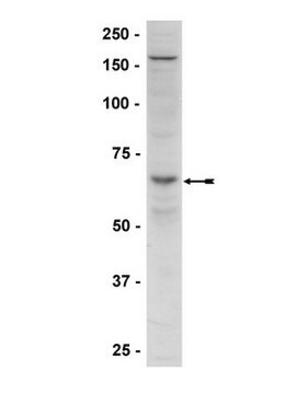 Anticorpo anti-fosfo-AMPK&#945; (Thr172) Upstate&#174;, from rabbit