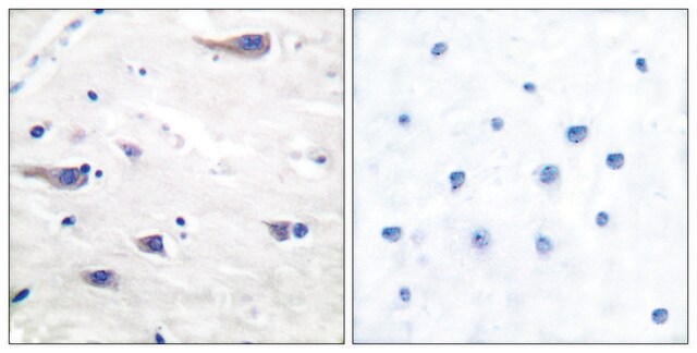 Anti-PDGF Receptor &#946; antibody produced in rabbit affinity isolated antibody