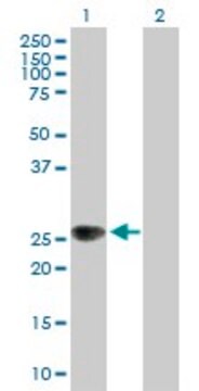 Anti-ZNRF1 antibody produced in mouse purified immunoglobulin, buffered aqueous solution