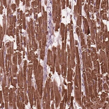 Anty-MYL3 Prestige Antibodies&#174; Powered by Atlas Antibodies, affinity isolated antibody