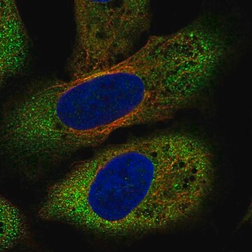 Anty-FZD8 Prestige Antibodies&#174; Powered by Atlas Antibodies, affinity isolated antibody