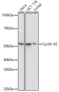 Anti-Cyclin A2 Antibody, clone 3E9Z3, Rabbit Monoclonal