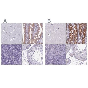 Anti-PLCB3 antibody produced in rabbit Prestige Antibodies&#174; Powered by Atlas Antibodies, affinity isolated antibody, buffered aqueous glycerol solution