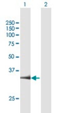 抗PARP16抗体 マウス宿主抗体 purified immunoglobulin, buffered aqueous solution