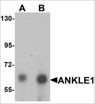 Anti-ANKLE1 antibody produced in chicken affinity isolated antibody