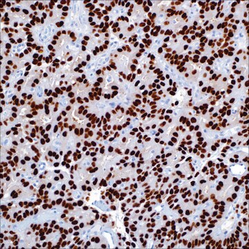 Androgen Receptor (SP107) Rabbit Monoclonal Antibody