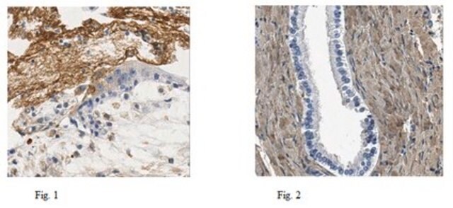 Anti-Fibronectin (Cell Attachment Fragment) Antibody, clone 3E3, Ascites &amp; Azide Free clone 3E3, from mouse