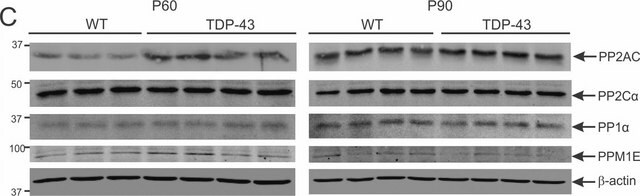 Anticuerpo anti-PP2A, subunidad C, clon 1D6 clone 1D6, Upstate&#174;, from mouse