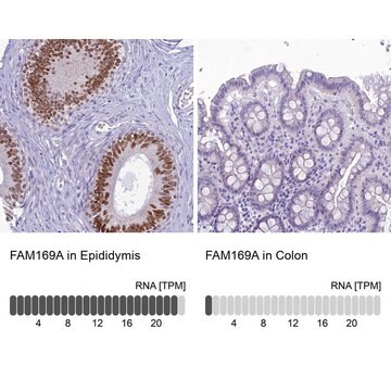 Anti-FAM169A antibody produced in rabbit Prestige Antibodies&#174; Powered by Atlas Antibodies, affinity isolated antibody, buffered aqueous glycerol solution