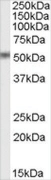 Anti-STEAP4/DUDULIN4 antibody produced in goat affinity isolated antibody, buffered aqueous solution