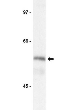 Anti-Kip2 Antibody Upstate&#174;, from rabbit