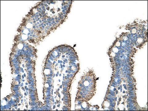 Anti-MMP1 IgG fraction of antiserum