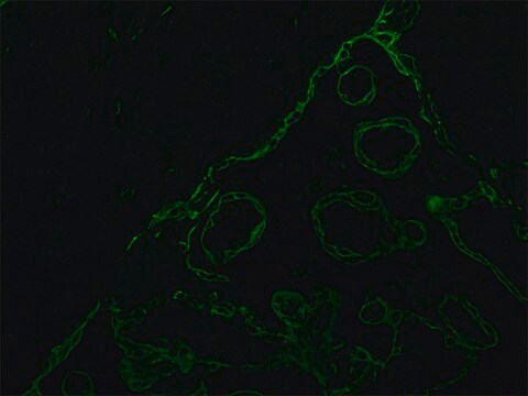 Monoclonal Anti-Cytokeratin Peptide 18 antibody produced in mouse clone KS-B17.2, ascites fluid