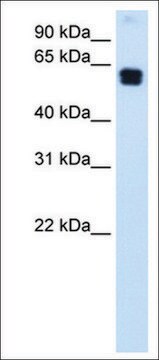 抗DOK1抗体 ウサギ宿主抗体 affinity isolated antibody