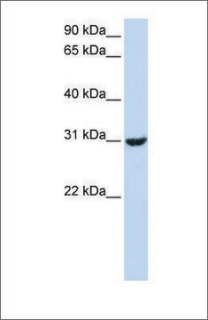 Anti-RNF182 (ab2) antibody produced in rabbit affinity isolated antibody