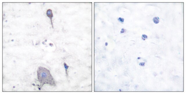 Anti-SIRP &#945;1, C-Terminal antibody produced in rabbit affinity isolated antibody