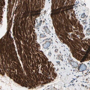 Anti-ACVR1 antibody produced in rabbit Prestige Antibodies&#174; Powered by Atlas Antibodies, affinity isolated antibody, buffered aqueous glycerol solution