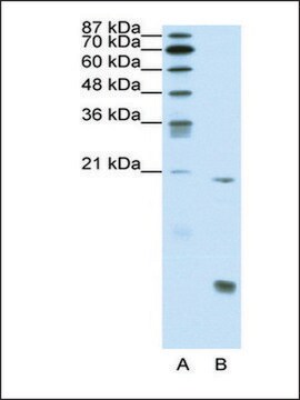 抗RUNX1抗体 ウサギ宿主抗体 affinity isolated antibody