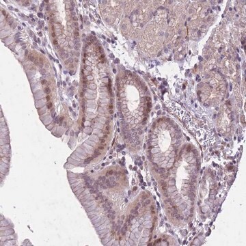 Anti-CBX6 antibody produced in rabbit Prestige Antibodies&#174; Powered by Atlas Antibodies, affinity isolated antibody, buffered aqueous glycerol solution