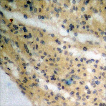 Anti-phospho-p90 RSK (pThr359+Ser363) antibody produced in rabbit affinity isolated antibody