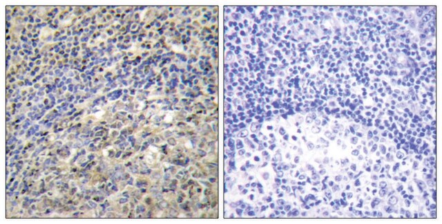 Anti-p47 PHOX antibody produced in rabbit affinity isolated antibody