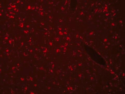 自发荧光消除剂 Autofluorescence Eliminator Reagent for IHC.