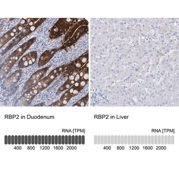 Anti-RBP2 antibody produced in rabbit Prestige Antibodies&#174; Powered by Atlas Antibodies, affinity isolated antibody, buffered aqueous glycerol solution