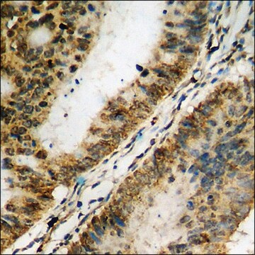 Anti-phospho-NF-kappaB p65 (pSer311) antibody produced in rabbit affinity isolated antibody