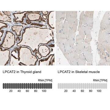 Anti-LPCAT2 antibody produced in rabbit Prestige Antibodies&#174; Powered by Atlas Antibodies, affinity isolated antibody, buffered aqueous glycerol solution