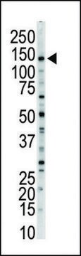 ANTI-MLCK(N-TERMINAL) antibody produced in rabbit IgG fraction of antiserum, buffered aqueous solution