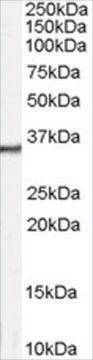 抗カルレチニン抗体 ヤギ宿主抗体 affinity isolated antibody, buffered aqueous solution