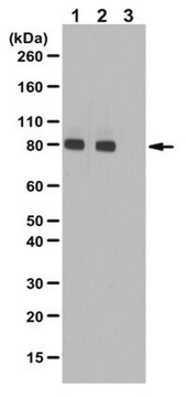 Anti-Phospho-PKC-epsilon-Antikörper (Ser729) from rabbit, purified by affinity chromatography