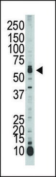 ANTI-SPAK (CENTER) antibody produced in rabbit IgG fraction of antiserum, buffered aqueous solution