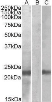 Anti-CST8 antibody produced in goat affinity isolated antibody, buffered aqueous solution