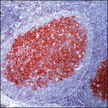 Anti-CD23 antibody, Rabbit monoclonal recombinant, expressed in proprietary host, clone SP23, tissue culture supernatant