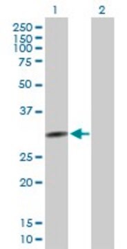 Anti-QPCTL antibody produced in mouse purified immunoglobulin, buffered aqueous solution