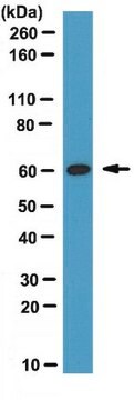 Anti-WAS protein family homolog 1 (CT) Antibody from rabbit