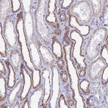 Anti-ACSM1 antibody produced in rabbit Prestige Antibodies&#174; Powered by Atlas Antibodies, affinity isolated antibody, buffered aqueous glycerol solution