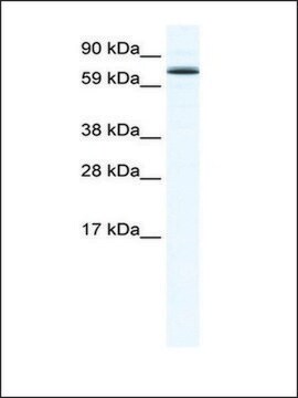 抗FOXO6 兔抗 IgG fraction of antiserum