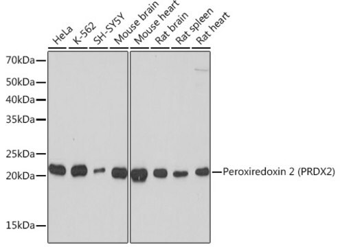 Anti-Peroxiredoxin 2 (PRDX2) Antibody, clone 1U9L9, Rabbit Monoclonal