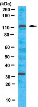 Przeciwciało anty-PTIP from chicken, purified by affinity chromatography