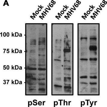 Anti-Phosphoserine Antibody Chemicon&#174;, from rabbit