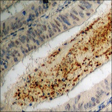 Anti-phospho-MEF2D (pSer444) antibody produced in rabbit affinity isolated antibody