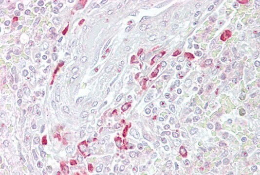 Anti-FRZB antibody produced in rabbit affinity isolated antibody