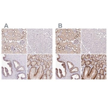 Anti-SLC9A1 antibody produced in rabbit Prestige Antibodies&#174; Powered by Atlas Antibodies, affinity isolated antibody, buffered aqueous glycerol solution