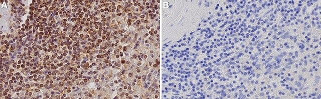 Anti-CD5 Antibody, clone 1M19 ZooMAb&#174; Rabbit Monoclonal recombinant, expressed in HEK 293 cells